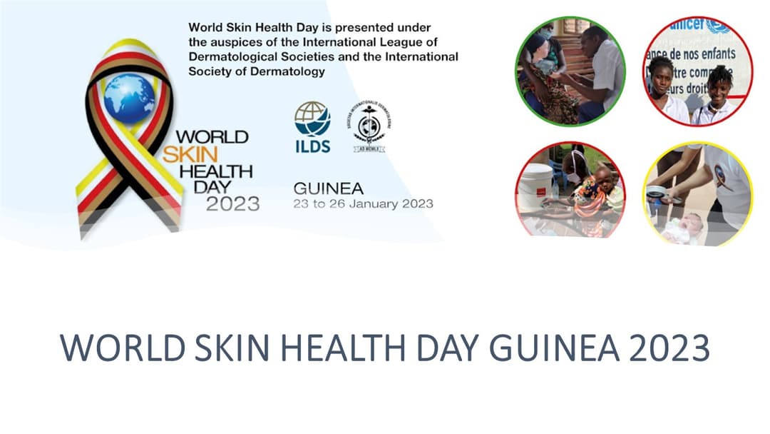 WORLD SKIN HEALTH DAY – GUINEA 2023