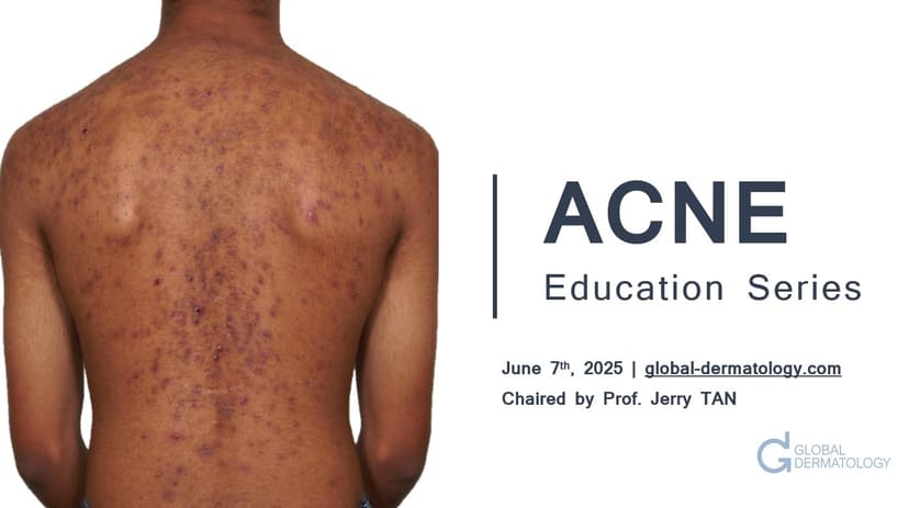 ACNE | Global Education Day 2025