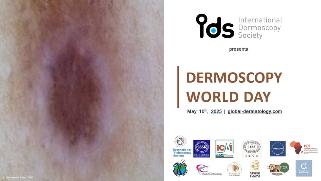 DERMOSCOPY | World Day 2025
